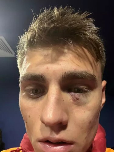 "Qalatasaray"ın futbolçusuna qarşı vəhşilik - FOTO